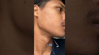 Minoxidil beard growth  2 month beard growth journey  Mintop minoxidil beard growth [upl. by Seafowl]