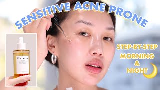 Korean Skincare for Acne Prone Skin WHOLE ROUTINE [upl. by Cusick270]