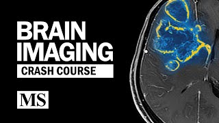 Brain Imaging Crash Course [upl. by Ycal]