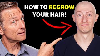 How to Regrow Your Hair UPDATED VITAL INFO  Hair Surgeon Reacts [upl. by Haisoj]