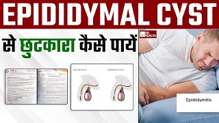 Epididymal सिस्ट cyst से छुटकारा कैसे पायें  Get rid of Epididymal cyst naturally  DrHealth [upl. by Htesil101]