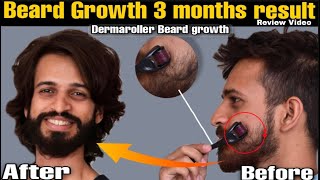 Dermaroller for beard growth  Derma roller beard before and after  Beard Products  review [upl. by Nilloc]