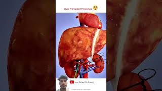 LIVER 😱 TRANSMISSION 🏥 anatomy medicalanimation motivation ytshort ytshortsindia ytviral [upl. by Neros]