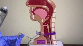 Digital occlusion for speech with tracheostomy [upl. by Ititrefen17]