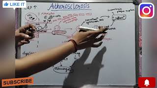 Atherosclerosis pathophysiology in detail  PG syllabus  GEETARU Shanjalii  KayachikitsaAyurved [upl. by Aslam]