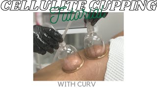 Cellulite Cupping Tutorial  How To Use Cellulite Cupping  Curv Vacuum and Cupping System [upl. by Oinotnaesoj]