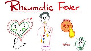 Rheumatic Fever  Jones Criteria  Causes Signs Symptoms Diagnosis amp Treatment  Cardiology [upl. by Nereids]