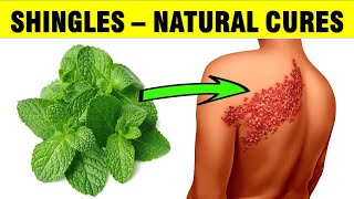 How To Treat Shingles Naturally  Homemade Remedies [upl. by Rector]