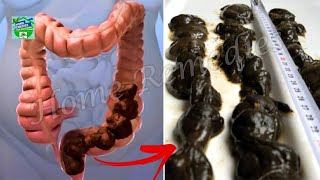 How To Clean Your Stomach and Intestines Naturally in One Day [upl. by Llyrrad816]