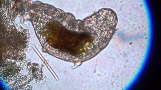 Tardigrade  Water Bear under microscope [upl. by Narud]