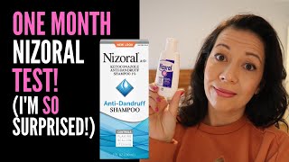 HAIR LOSS SUFFERER REVIEWS NIZORAL SHAMPOO One Month Review On 2 Ketoconazole IM VERY SURPRISED [upl. by Snider88]