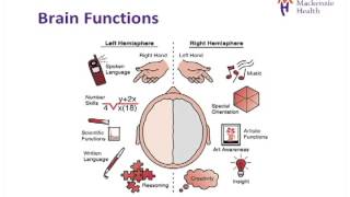 Stroke Education  Causes and Effects [upl. by Nnahgiel]