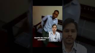 NEUROLOGY IDENTIFY THE CLINICAL CONDITION neurology neuro shorts physiotherapy viralvideo [upl. by Anitram]