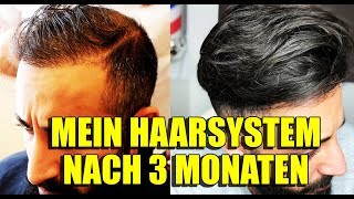 MEIN HAARSYSTEM NACH 3 MONATEN  VOLLE HAARE OHNE OP  BARTMANN [upl. by Sinnek795]