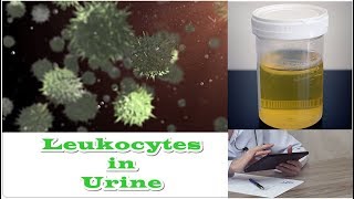 Leukocytes in Urine  No Nitrates [upl. by Farland751]