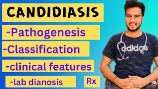 Candidiasis microbiologypathogenesislabdiagnosisTreatment [upl. by Liamaj]