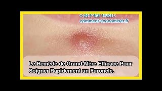 Le Remède de GrandMère Efficace Pour Soigner Rapidement un Furoncle [upl. by Nnaeinahpets]