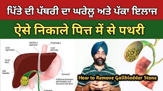 ਪਿੱਤੇ ਦੀ ਪੱਥਰੀ ਲਈ ਇਕ ਵਾਰ ਇਵੇਂ ਕਰੋ  Treatment of Gallbladder Stone  dstalanian [upl. by Gefen]