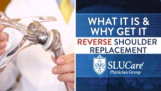 What Is A Reverse Shoulder Replacement  SLUCare Orthopedic Surgery [upl. by Noevart]