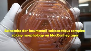 Acinetobacter baumannii calcoaceticus complex colony morphology on Macconkey agar [upl. by Laeno]