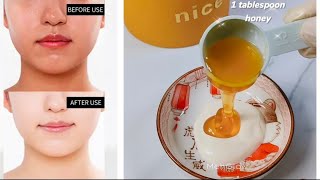 Top 10 Remedies For Whitening amp Remove Dark Spots amp Hyperpigmentation [upl. by Jolene979]