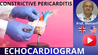 How to Escape the Grip of Constrictive Pericarditis Echocardiography Diagnose [upl. by Barnie]