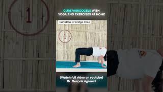 Yoga Aasan for Varicocele at Home  Part 4 varicoceletreatment yogaasanas [upl. by Wycoff618]