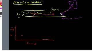 Arterial Line Waveform [upl. by Goodkin]