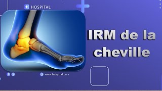 IRM de la cheville Bonne Pratique [upl. by Shandie]