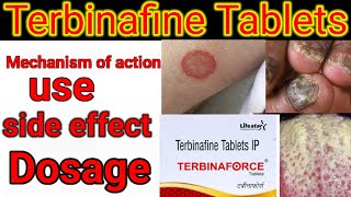 Terbinafine Tablets IP 250mg500mg in hindi Mechanism of action side effects dose [upl. by Enelkcaj]