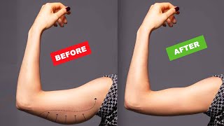 Burn Flabby ARMS FAT 10 Minute Arm Flab Workout  No Equipment Needed [upl. by Trager]