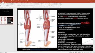 Harvest plantaris tendon [upl. by Burnsed765]