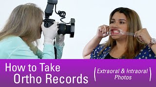 How to Take Orthodontic Records [upl. by Erreip399]