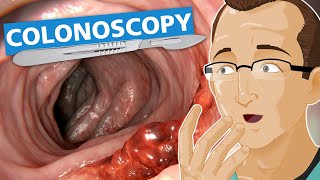 Colonoscopy [upl. by Magocsi32]