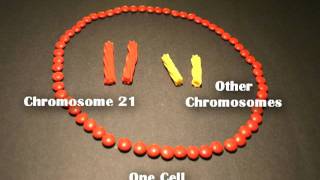 Nondisjunction Trisomy 21  An Animated Tutorial [upl. by Onoitna777]