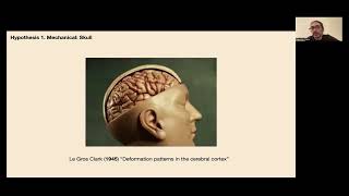 OHBM 2024  Educational Course  Precision surface imaging of the cerebral cortex  Part 7 [upl. by Cuhp]