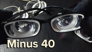 40 extreme myopia with biconcave myodisc lens [upl. by Lavoie820]