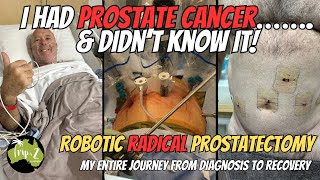 PROSTATE CANCER  My full journey from Diagnosis to Recovery  Ep 69 [upl. by Millda40]