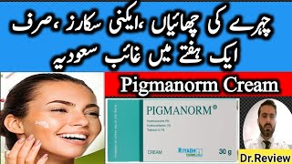 pigmanorm cream uses treatment of face frecklesacne scarspimple scarsHyperpigmentation [upl. by Aryk]