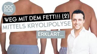 KRYOLIPOLYSE BEHANDLUNG – Fett weg Teil 2 mit Dr Rolf Bartsch [upl. by Ytsirk]