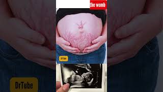 baby in 36 week in mother womb  baby in the womb 37 weeks development baby belly pregnancy [upl. by Ydisahc961]