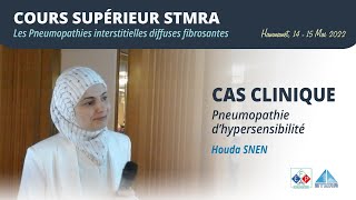 Cas clinique sur la pneumopathie dhypersensibilité [upl. by Jacquie]