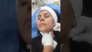 Carboxiterapia ¡Logra efecto Lifting en cara y cuello 😱😳😃 [upl. by Atekihs]