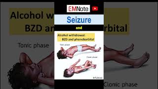 Nontypical Seizures [upl. by Ecirpac842]