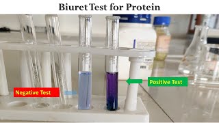 Biuret Test [upl. by Ecirtap]