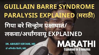 GUILLAIN BARRE SYNDROME EXPLAINED IN MARATHI presentation causes symptoms treatment prevention [upl. by Emirak]