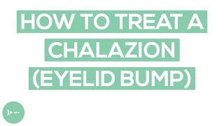 Chalazion Eyelid Bump Treatment  Exactly How To Treat a Chalazion [upl. by Ekenna935]