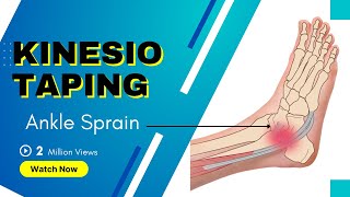 How to treat an Ankle Inversion Sprain  Kinesiology Taping to stabilise ligaments [upl. by Gorrono]