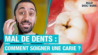 🦷 Comment soigner une CARIE  Les réponses du Dr Jimmy Mohamed [upl. by Jaal]