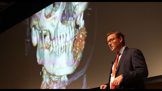 Dr Jeffrey Marschall on his use of ViviGen in complex CMF procedures [upl. by Fowler]